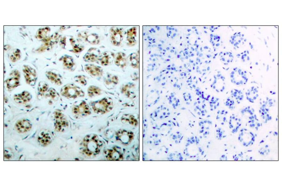 Immunohistochemistry - NFκB-p65 (phospho-Ser311) Antibody from Signalway Antibody (11260) - Antibodies.com