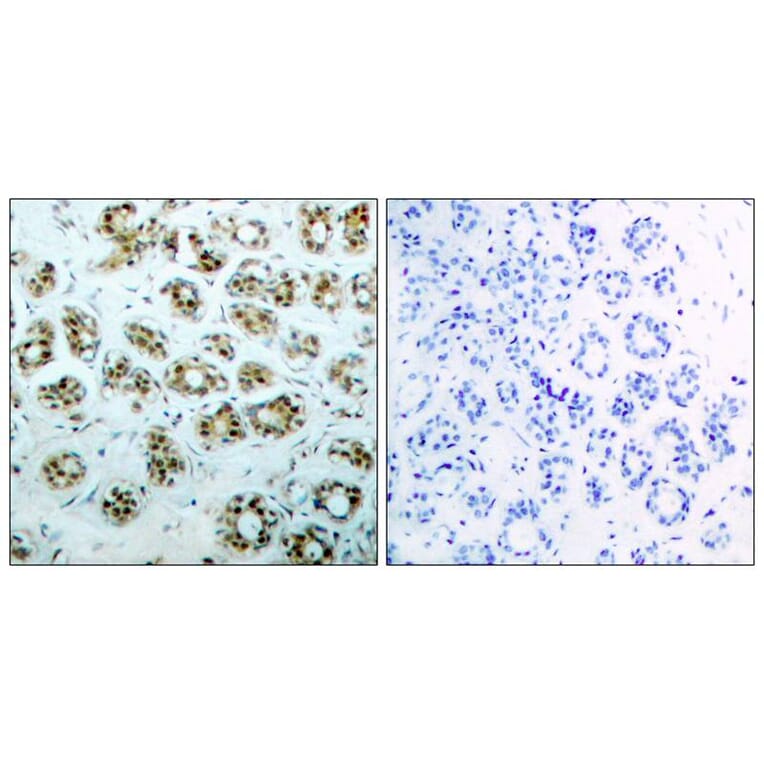 Immunohistochemistry - NFκB-p65 (phospho-Ser311) Antibody from Signalway Antibody (11260) - Antibodies.com