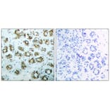 Immunohistochemistry - NFκB-p65 (phospho-Ser311) Antibody from Signalway Antibody (11260) - Antibodies.com