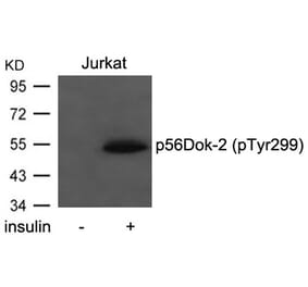 Western blot - p56Dok-2 (Phospho-Tyr299) Antibody from Signalway Antibody (11278) - Antibodies.com
