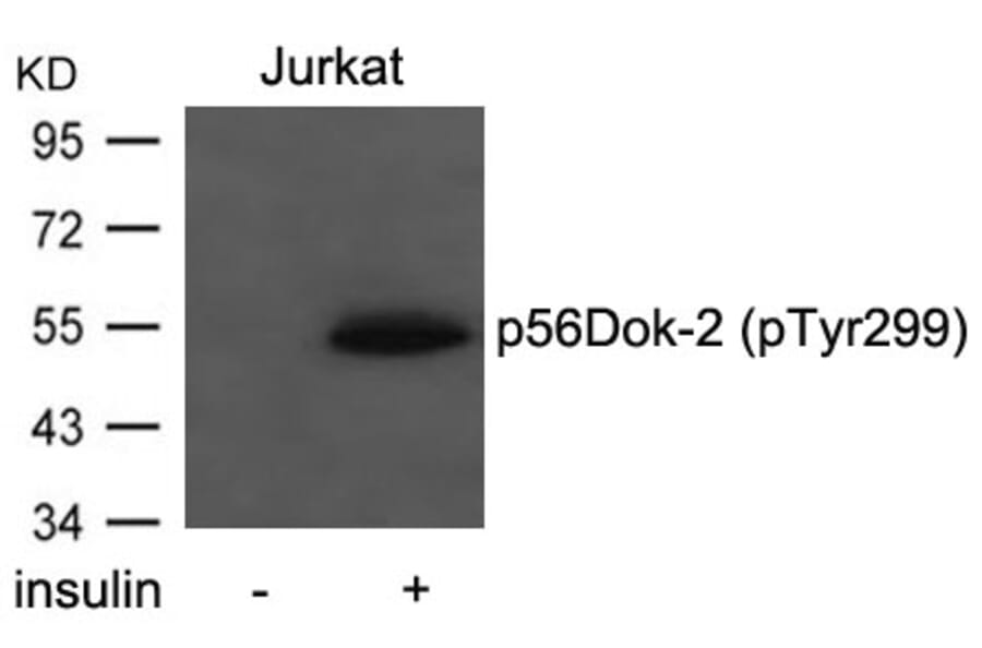 Western blot - p56Dok-2 (Phospho-Tyr299) Antibody from Signalway Antibody (11278) - Antibodies.com