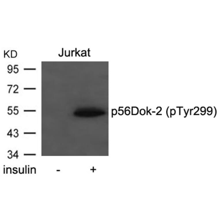 Western blot - p56Dok-2 (Phospho-Tyr299) Antibody from Signalway Antibody (11278) - Antibodies.com