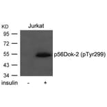 Western blot - p56Dok-2 (Phospho-Tyr299) Antibody from Signalway Antibody (11278) - Antibodies.com