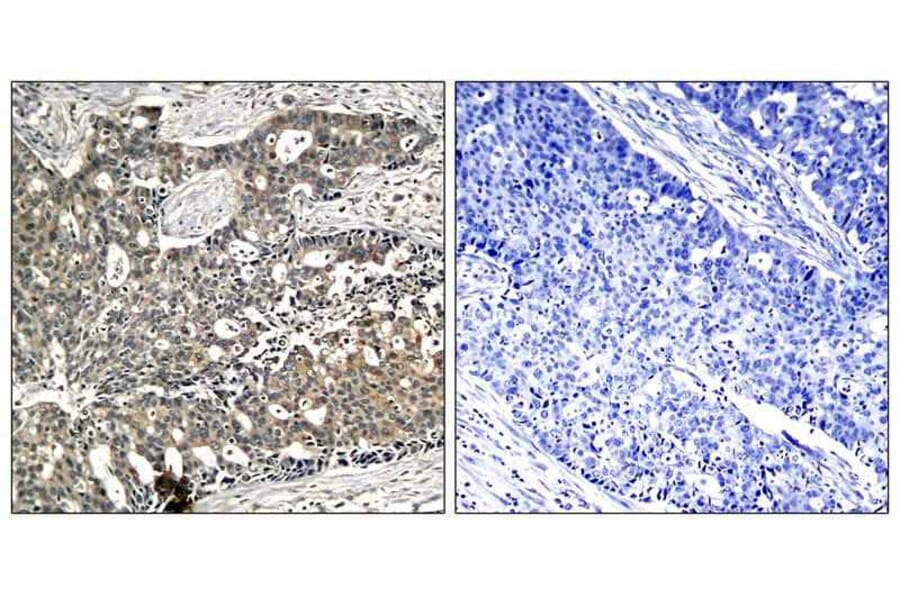 Immunohistochemistry - p56Dok-2 (Phospho-Tyr299) Antibody from Signalway Antibody (11278) - Antibodies.com