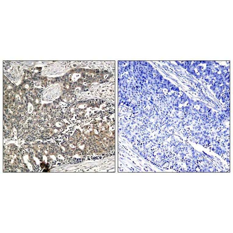 Immunohistochemistry - p56Dok-2 (Phospho-Tyr299) Antibody from Signalway Antibody (11278) - Antibodies.com