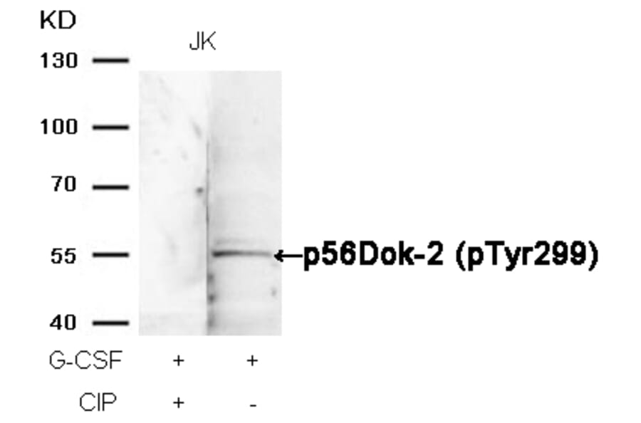 Western blot - p56Dok-2 (Phospho-Tyr299) Antibody from Signalway Antibody (11278) - Antibodies.com