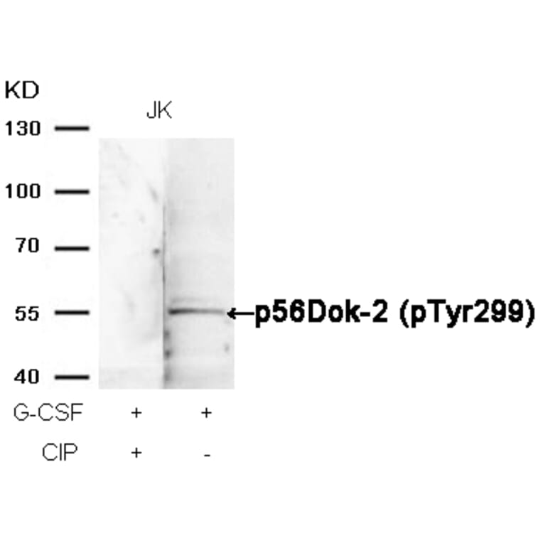 Western blot - p56Dok-2 (Phospho-Tyr299) Antibody from Signalway Antibody (11278) - Antibodies.com