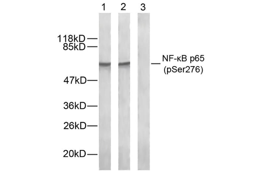 Western blot - NFκB-p65 (Phospho-Ser276) Antibody from Signalway Antibody (11011) - Antibodies.com