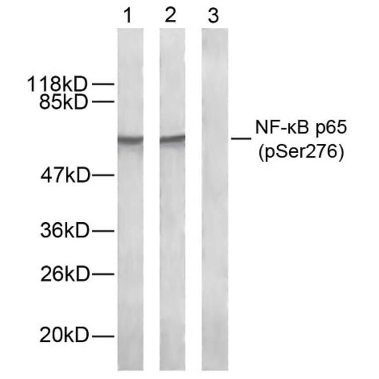 Western blot - NFκB-p65 (Phospho-Ser276) Antibody from Signalway Antibody (11011) - Antibodies.com