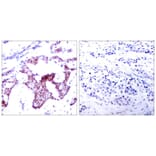 Immunohistochemistry - NFκB-p65 (Phospho-Ser276) Antibody from Signalway Antibody (11011) - Antibodies.com