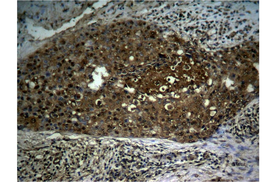 Immunohistochemistry - NFκB-p65 (Phospho-Ser276) Antibody from Signalway Antibody (11011) - Antibodies.com