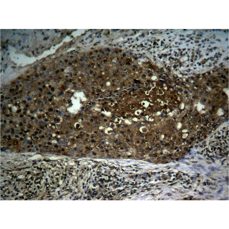 Immunohistochemistry - NFκB-p65 (Phospho-Ser276) Antibody from Signalway Antibody (11011) - Antibodies.com