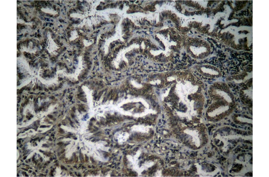 Immunohistochemistry - NFκB-p65 (Phospho-Ser276) Antibody from Signalway Antibody (11011) - Antibodies.com