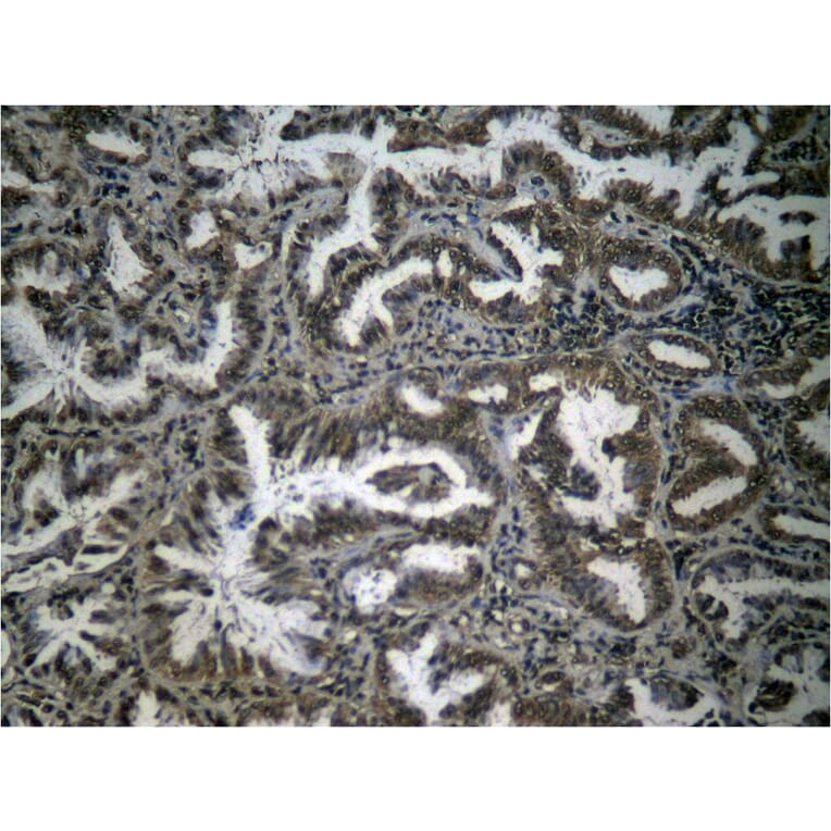 Immunohistochemistry - NFκB-p65 (Phospho-Ser276) Antibody from Signalway Antibody (11011) - Antibodies.com