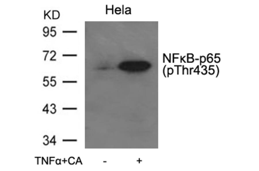 Western blot - NFkB-p65 (Phospho-Thr435) Antibody from Signalway Antibody (11012) - Antibodies.com
