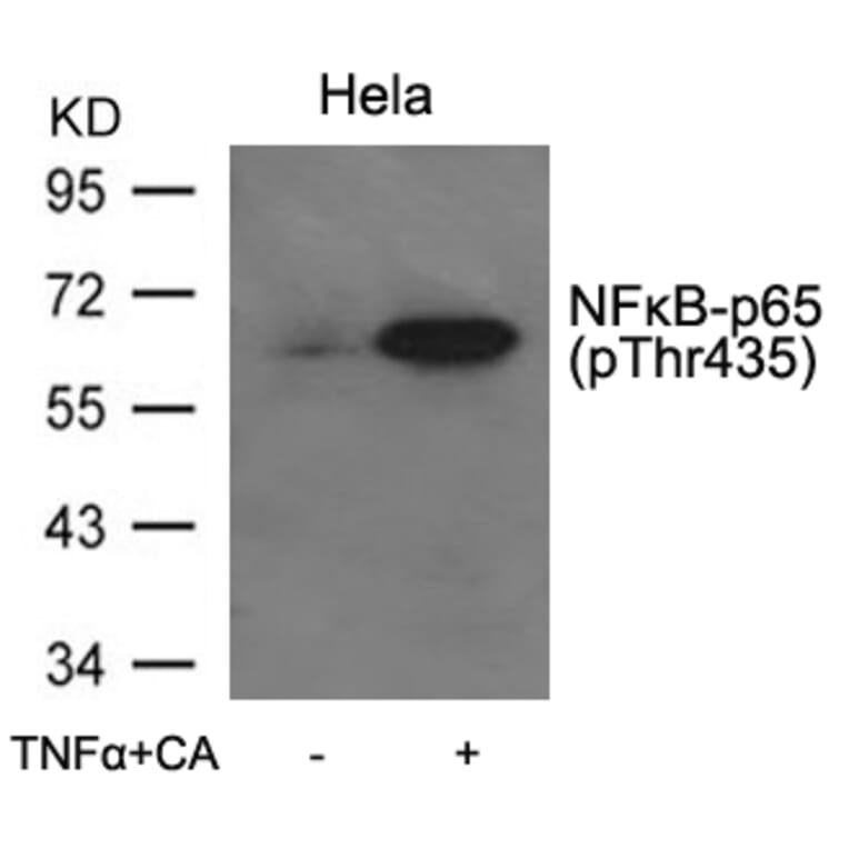 Western blot - NFkB-p65 (Phospho-Thr435) Antibody from Signalway Antibody (11012) - Antibodies.com