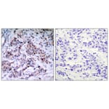 Immunohistochemistry - NFkB-p65 (Phospho-Thr435) Antibody from Signalway Antibody (11012) - Antibodies.com