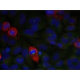 Immunofluorescence - NFkB-p65 (Phospho-Thr435) Antibody from Signalway Antibody (11012) - Antibodies.com