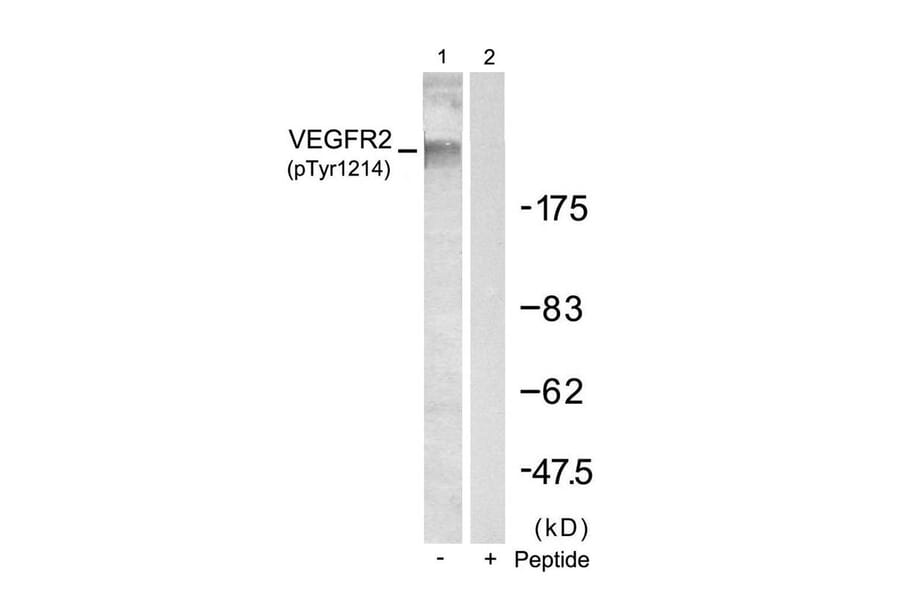 Western blot - VEGFR2 (Phospho-Tyr1214) Antibody from Signalway Antibody (11085) - Antibodies.com