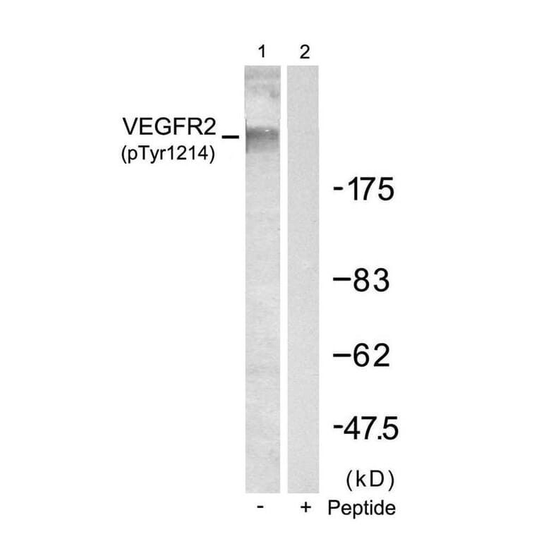 Western blot - VEGFR2 (Phospho-Tyr1214) Antibody from Signalway Antibody (11085) - Antibodies.com