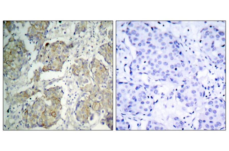 Immunohistochemistry - VEGFR2 (Phospho-Tyr1214) Antibody from Signalway Antibody (11085) - Antibodies.com