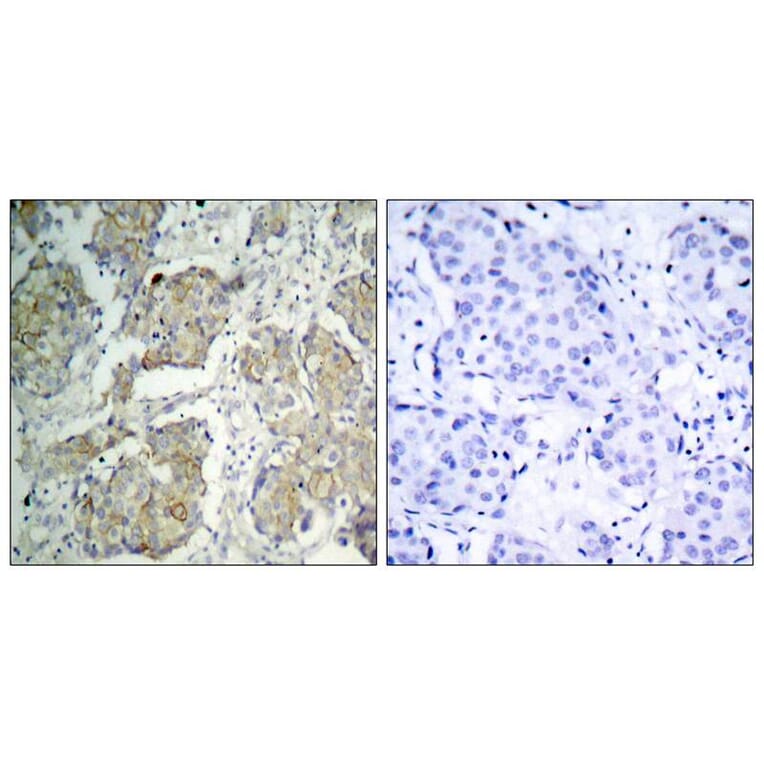 Immunohistochemistry - VEGFR2 (Phospho-Tyr1214) Antibody from Signalway Antibody (11085) - Antibodies.com