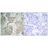 Immunohistochemistry - VEGFR2 (Phospho-Tyr1214) Antibody from Signalway Antibody (11085) - Antibodies.com