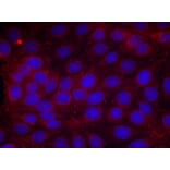 Immunofluorescence - VEGFR2 (Phospho-Tyr1214) Antibody from Signalway Antibody (11085) - Antibodies.com