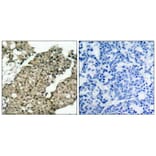 Immunohistochemistry - G3BP-1 (Phospho-Ser232) Antibody from Signalway Antibody (11082) - Antibodies.com