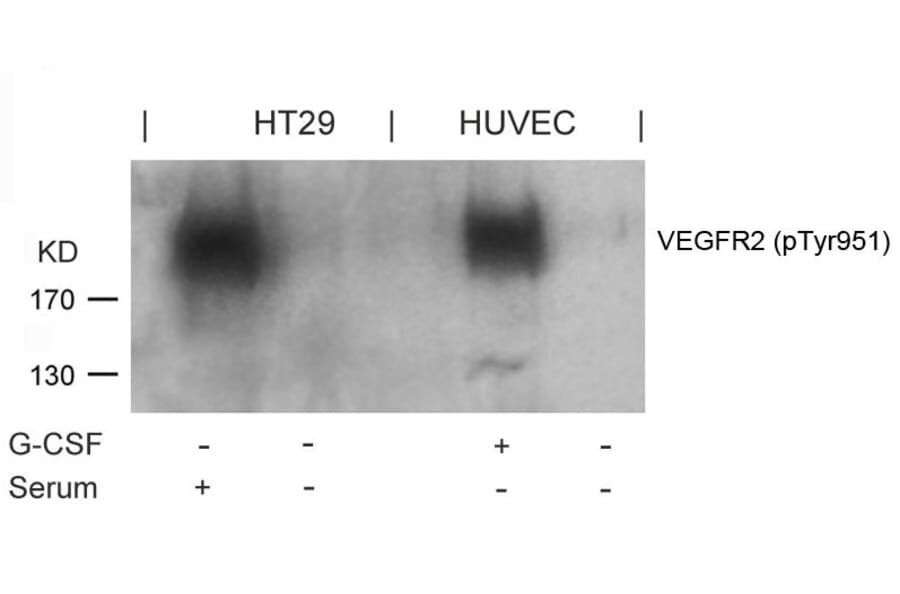 Western blot - VEGFR2 (Phospho-Tyr951) Antibody from Signalway Antibody (11086) - Antibodies.com