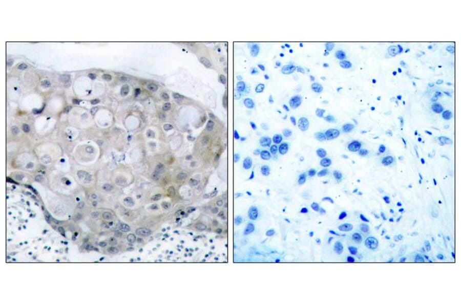 Immunohistochemistry - VEGFR2 (Phospho-Tyr951) Antibody from Signalway Antibody (11086) - Antibodies.com