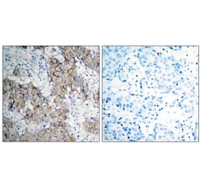Immunohistochemistry - IGF-1R (Phospho-Tyr1161) Antibody from Signalway Antibody (11087) - Antibodies.com