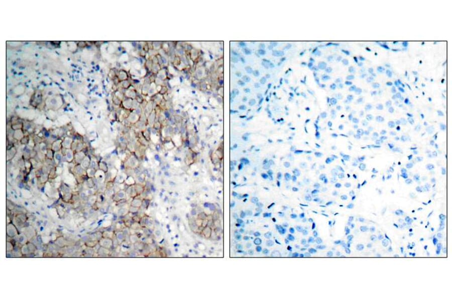 Immunohistochemistry - IGF-1R (Phospho-Tyr1161) Antibody from Signalway Antibody (11087) - Antibodies.com