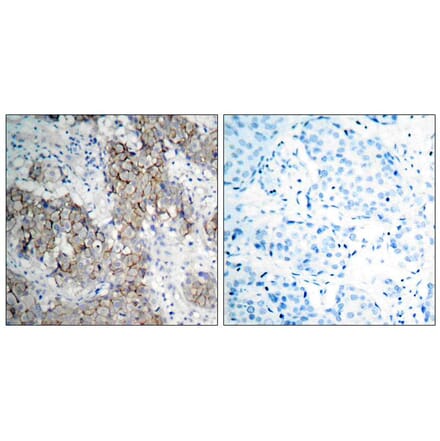 Immunohistochemistry - IGF-1R (Phospho-Tyr1161) Antibody from Signalway Antibody (11087) - Antibodies.com