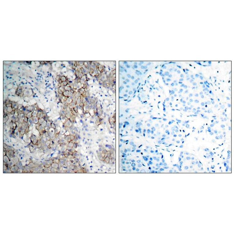 Immunohistochemistry - IGF-1R (Phospho-Tyr1161) Antibody from Signalway Antibody (11087) - Antibodies.com