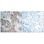 Immunohistochemistry - IGF-1R (Phospho-Tyr1161) Antibody from Signalway Antibody (11087) - Antibodies.com