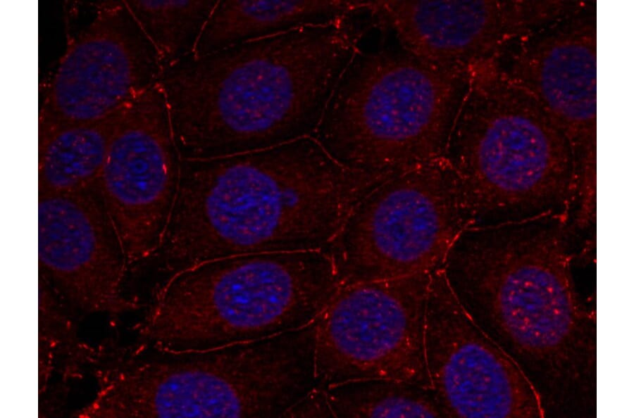 Immunofluorescence - IGF-1R (Phospho-Tyr1161) Antibody from Signalway Antibody (11087) - Antibodies.com