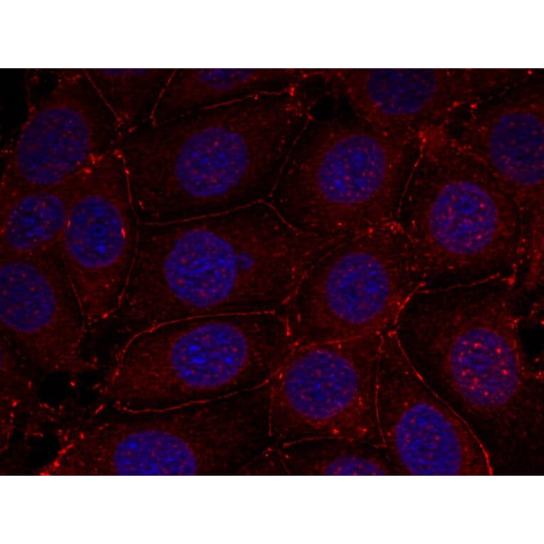 Immunofluorescence - IGF-1R (Phospho-Tyr1161) Antibody from Signalway Antibody (11087) - Antibodies.com