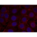 Immunofluorescence - IGF-1R (Phospho-Tyr1161) Antibody from Signalway Antibody (11087) - Antibodies.com