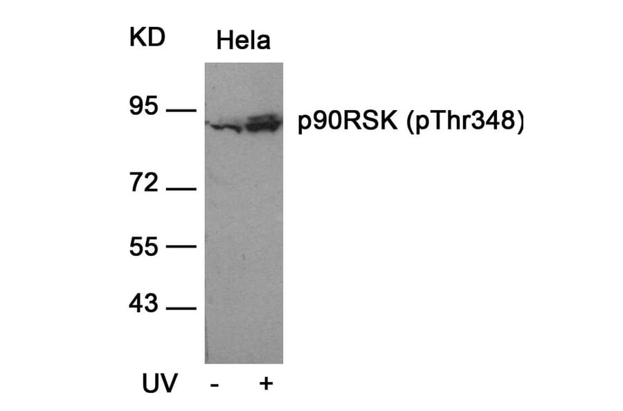 Western blot - p90RSK (Phospho-Thr348) Antibody from Signalway Antibody (11105) - Antibodies.com