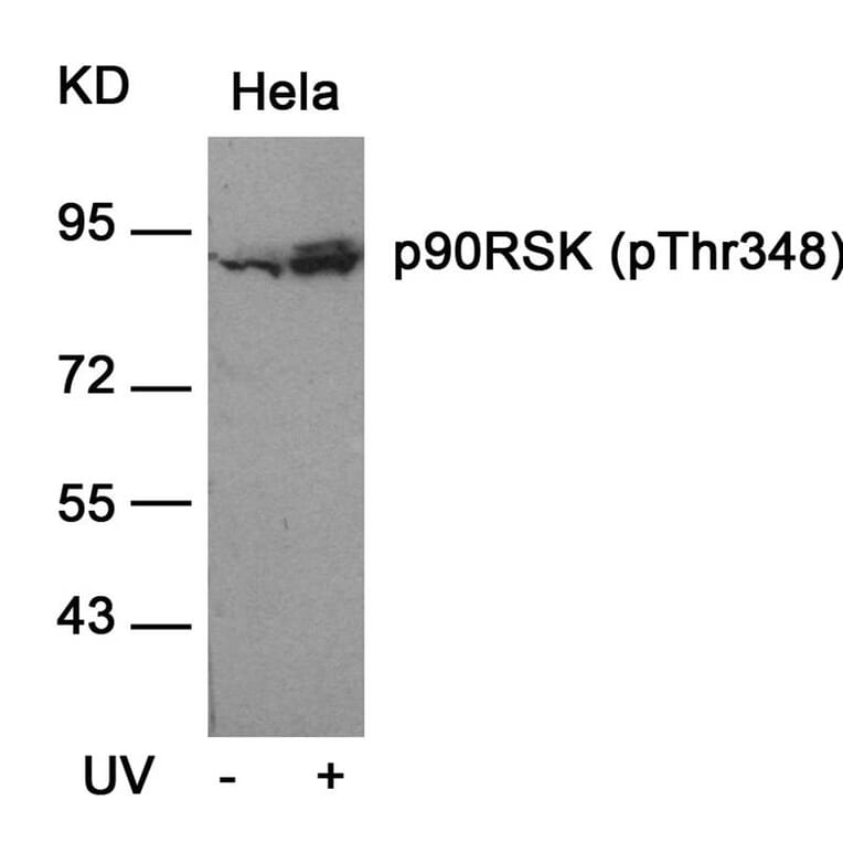 Western blot - p90RSK (Phospho-Thr348) Antibody from Signalway Antibody (11105) - Antibodies.com