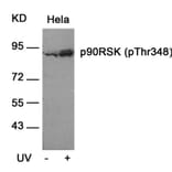 Western blot - p90RSK (Phospho-Thr348) Antibody from Signalway Antibody (11105) - Antibodies.com