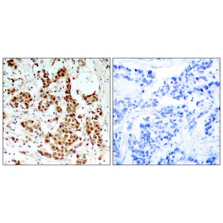 Immunohistochemistry - p90RSK (Phospho-Thr348) Antibody from Signalway Antibody (11105) - Antibodies.com