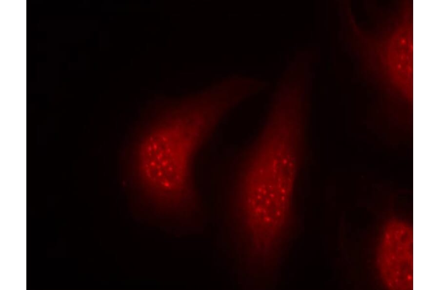 Immunofluorescence - p90RSK (Phospho-Thr348) Antibody from Signalway Antibody (11105) - Antibodies.com