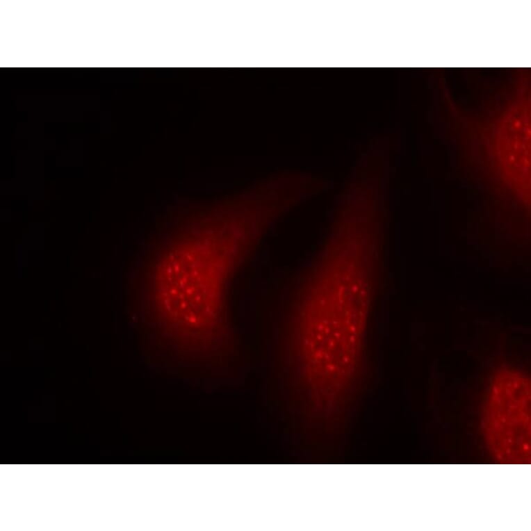 Immunofluorescence - p90RSK (Phospho-Thr348) Antibody from Signalway Antibody (11105) - Antibodies.com