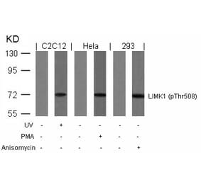 Western blot - LIMK1 (Phospho-Thr508) Antibody from Signalway Antibody (11126) - Antibodies.com