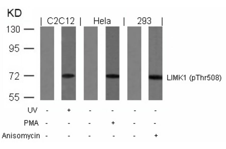 Western blot - LIMK1 (Phospho-Thr508) Antibody from Signalway Antibody (11126) - Antibodies.com