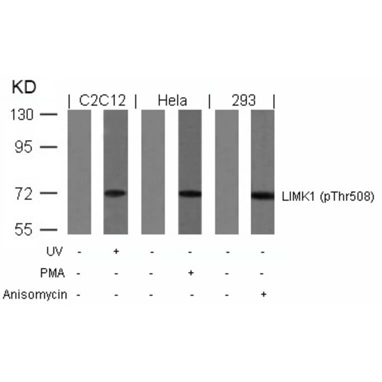 Western blot - LIMK1 (Phospho-Thr508) Antibody from Signalway Antibody (11126) - Antibodies.com