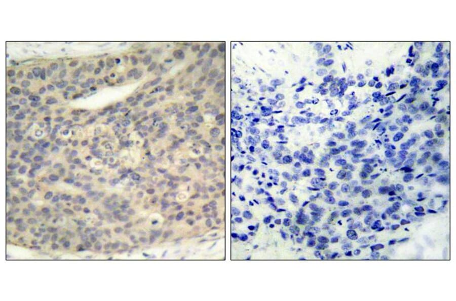 Immunohistochemistry - LIMK1 (Phospho-Thr508) Antibody from Signalway Antibody (11126) - Antibodies.com