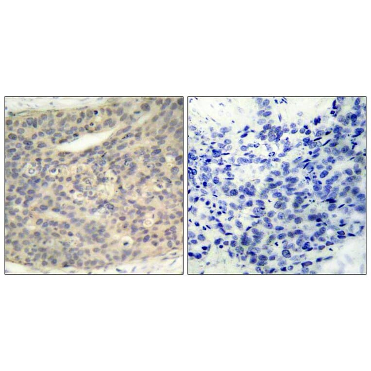 Immunohistochemistry - LIMK1 (Phospho-Thr508) Antibody from Signalway Antibody (11126) - Antibodies.com